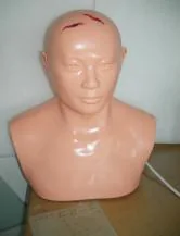 Cắt lọc vết thương khâu đầu