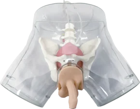 Mô hình: đặt ống thông nam