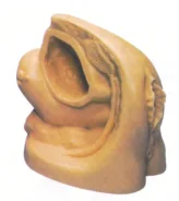 Mô đun: đặt ống thông nữ
