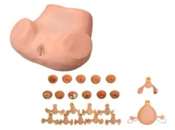 Mô hình: sản phụ khoa (nâng cao)